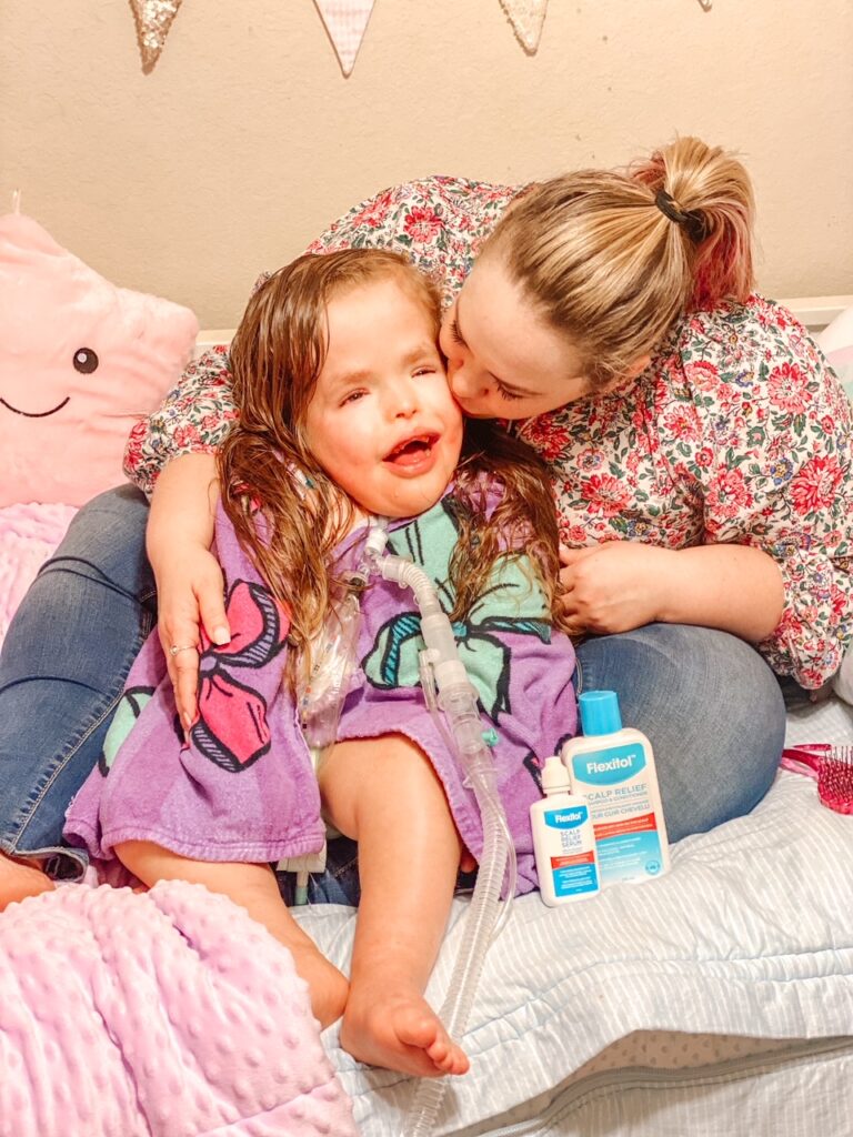 Looking for ways to keep a healthy scalp? Check out these tips from a mom that's tried everything after her daughter had a scarring alopecia diagnosis.