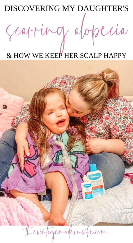 Looking for ways to keep a healthy scalp? Check out these tips from a mom that's tried everything after her daughter had a scarring alopecia diagnosis.